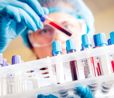 Lab technician with head cover and gloved hands placing a test tube with blood into a tray filled with other test tubes.